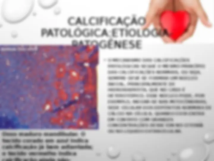 pf35