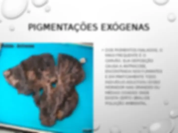 pf20