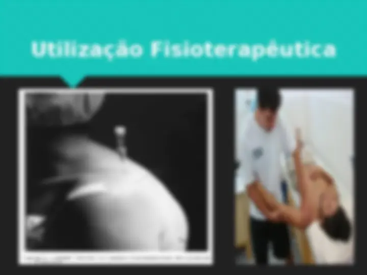 pf15