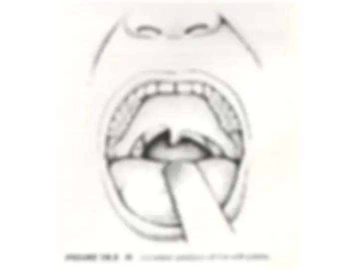 pf27
