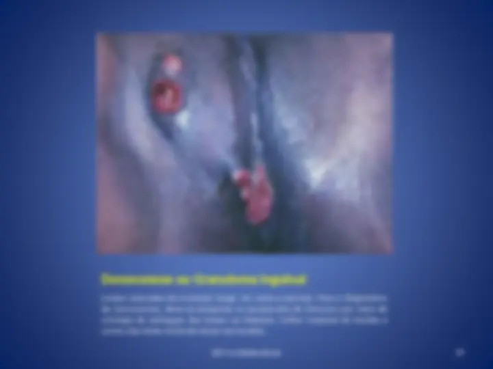 pf27