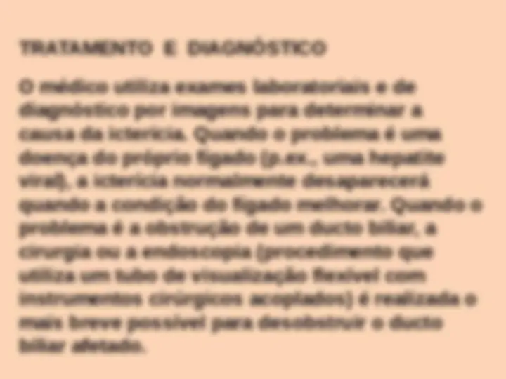 pfd