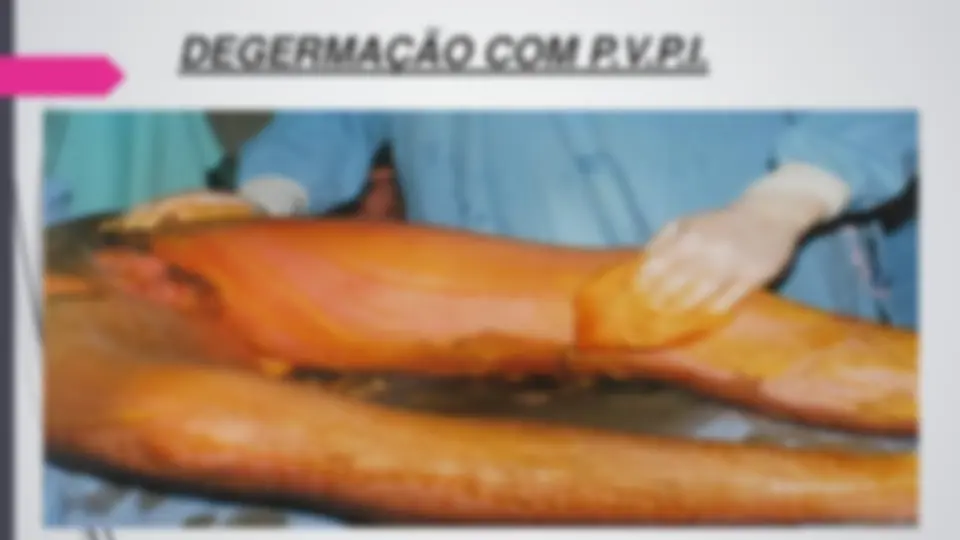 pf24