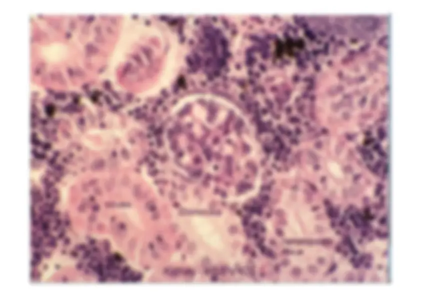 pf28