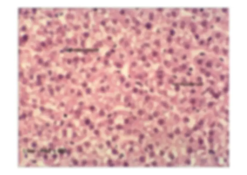 pf15