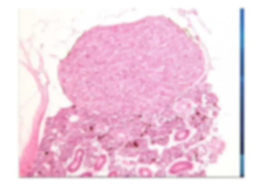 pf2a
