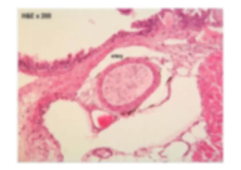pf1a
