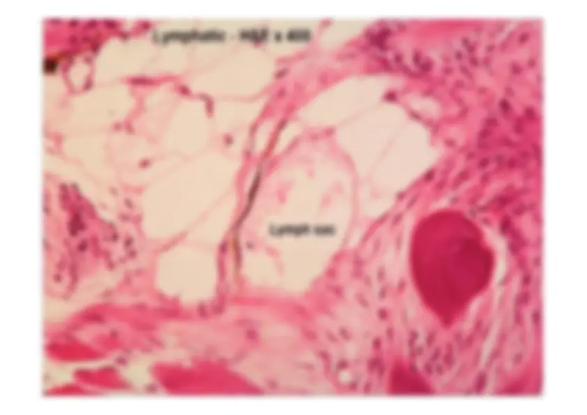 pf23