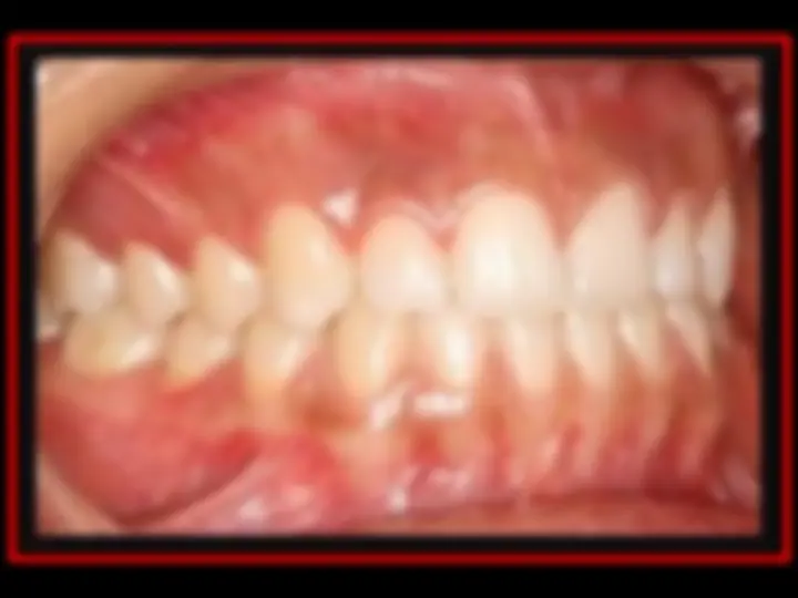 pf2f