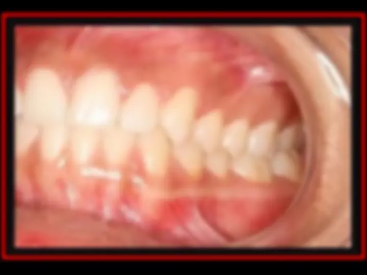 pf30