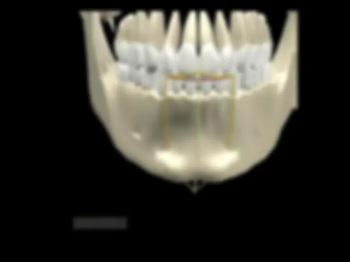 pf1a