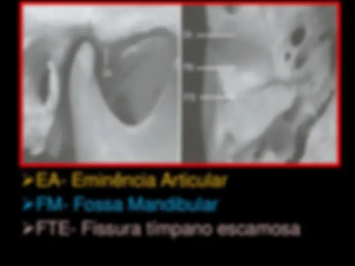 pf32