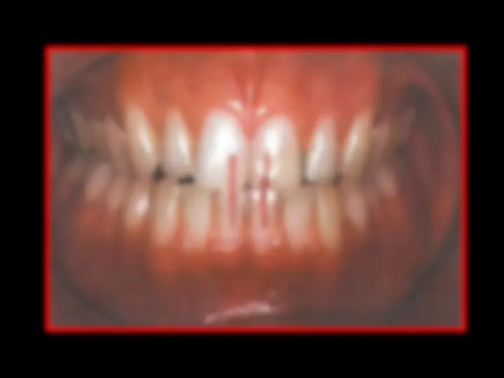 pf19