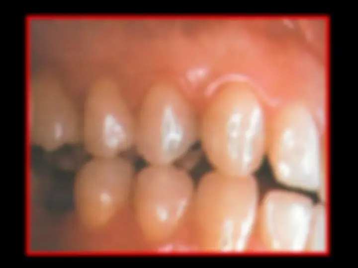 pf28