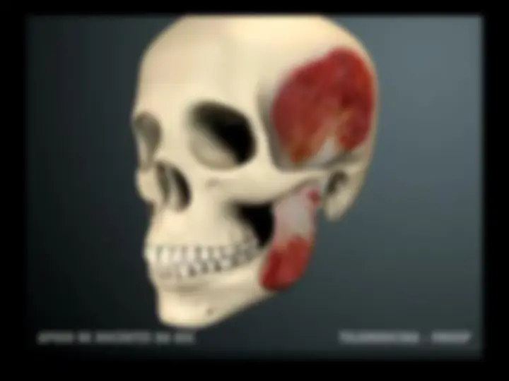 pf3f