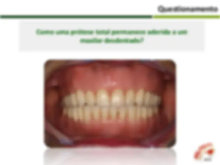 pf4
