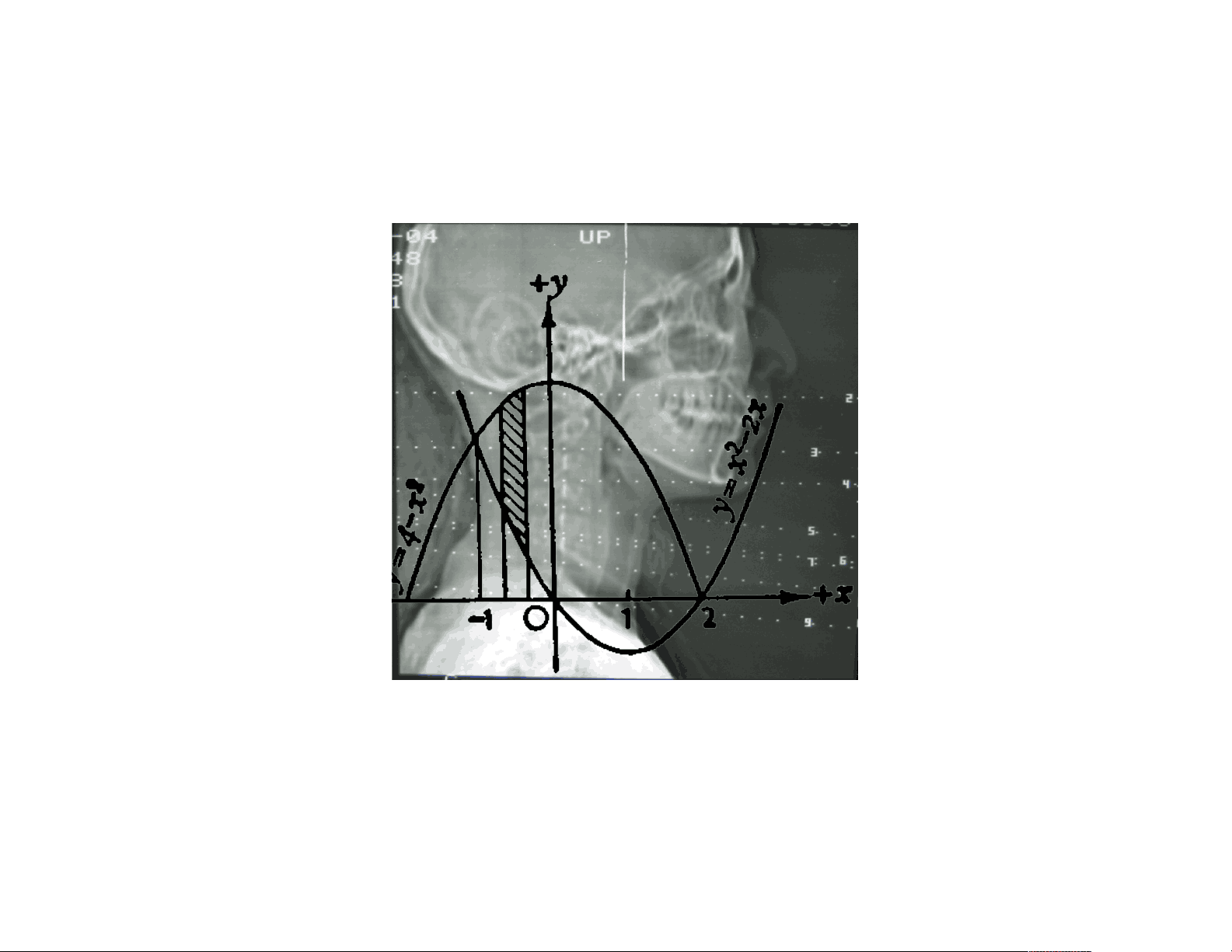 bg1