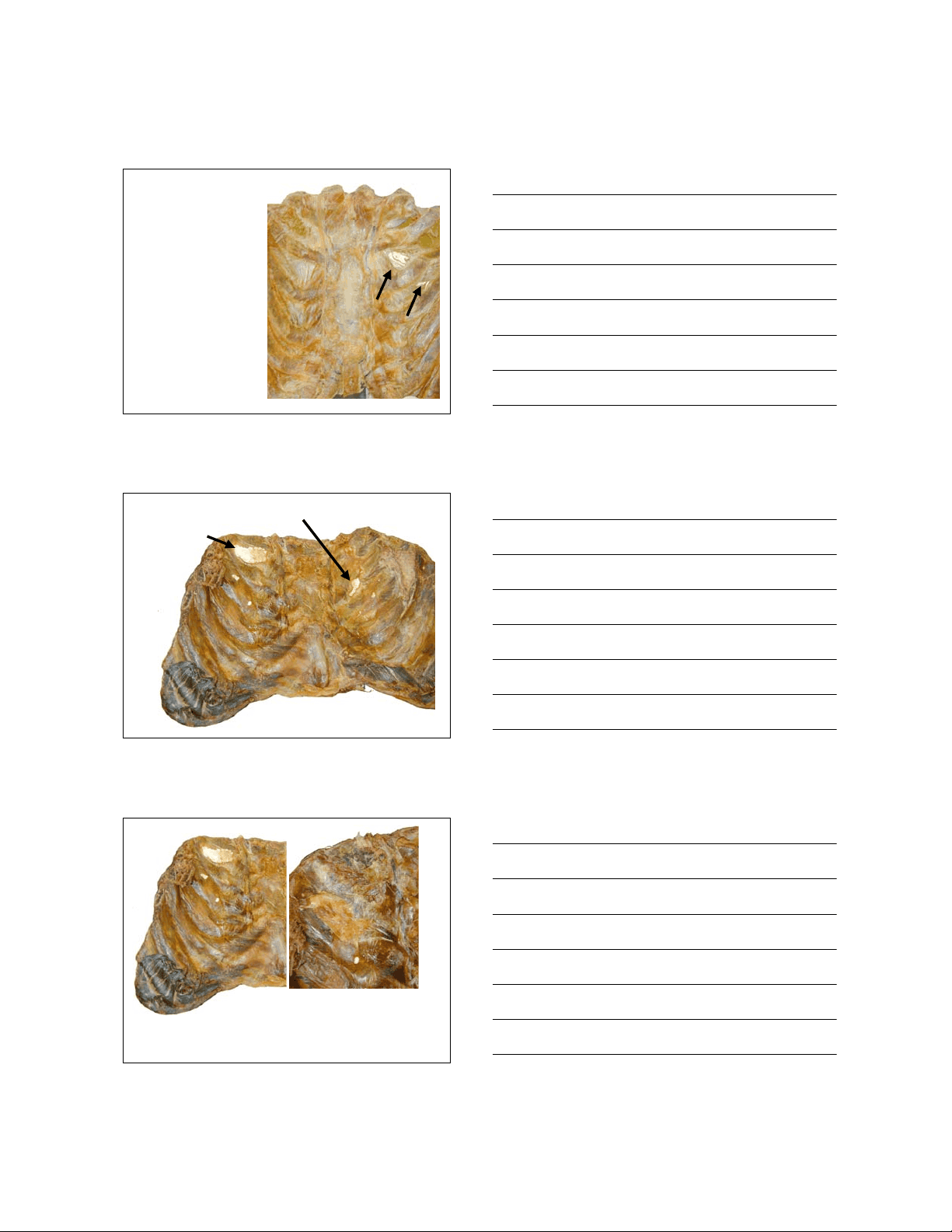 bg1