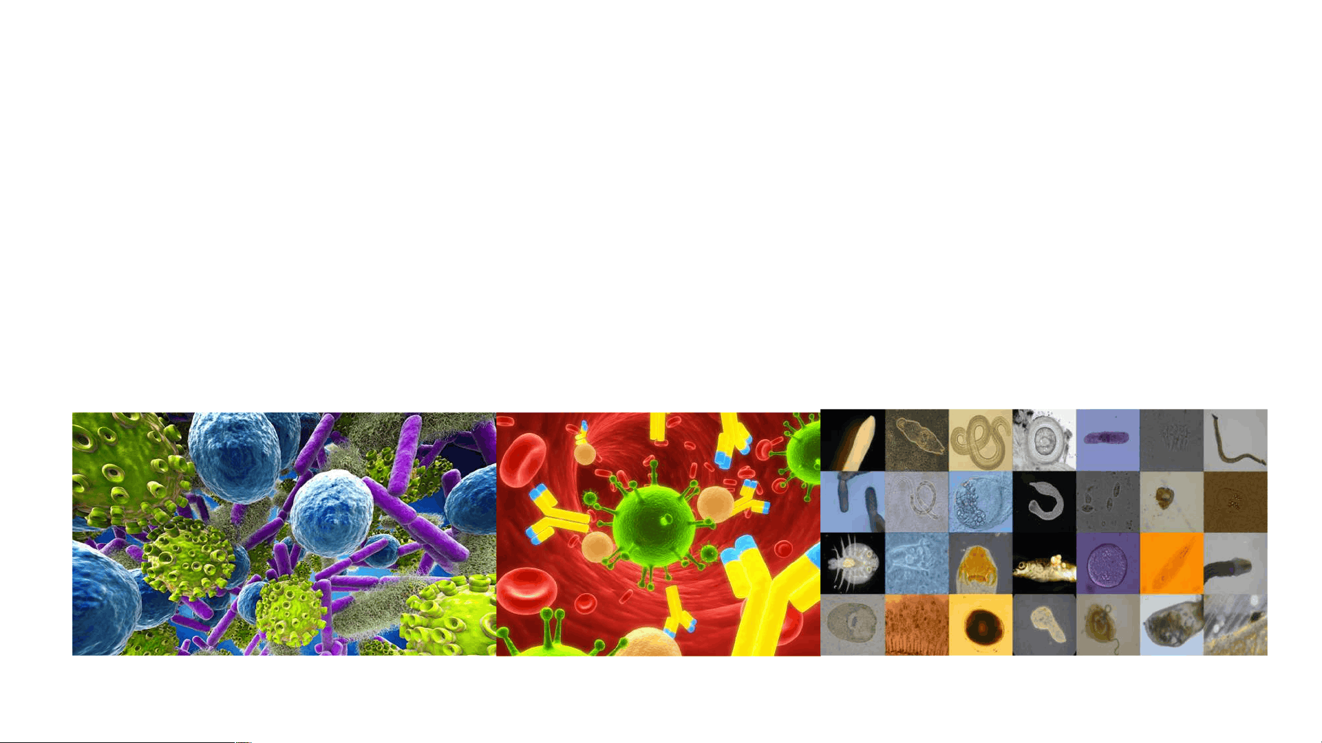 bg1
