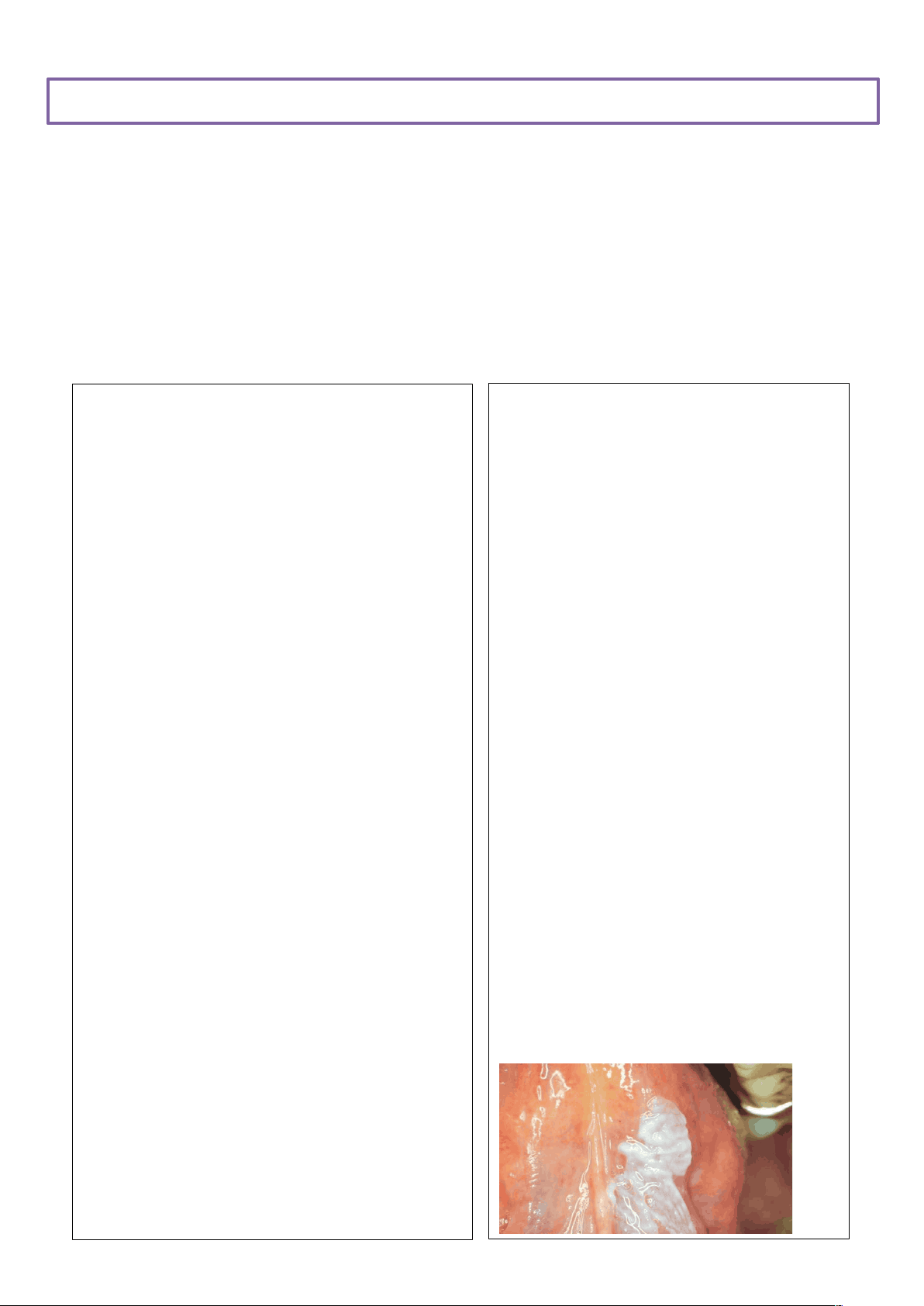 bg1