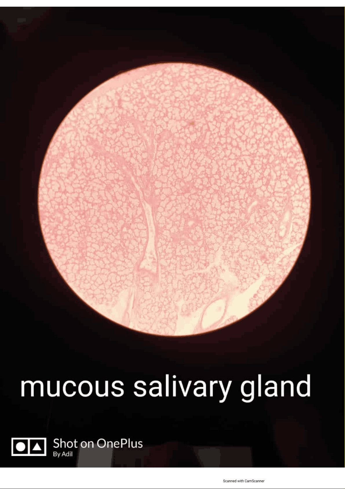 bg1
