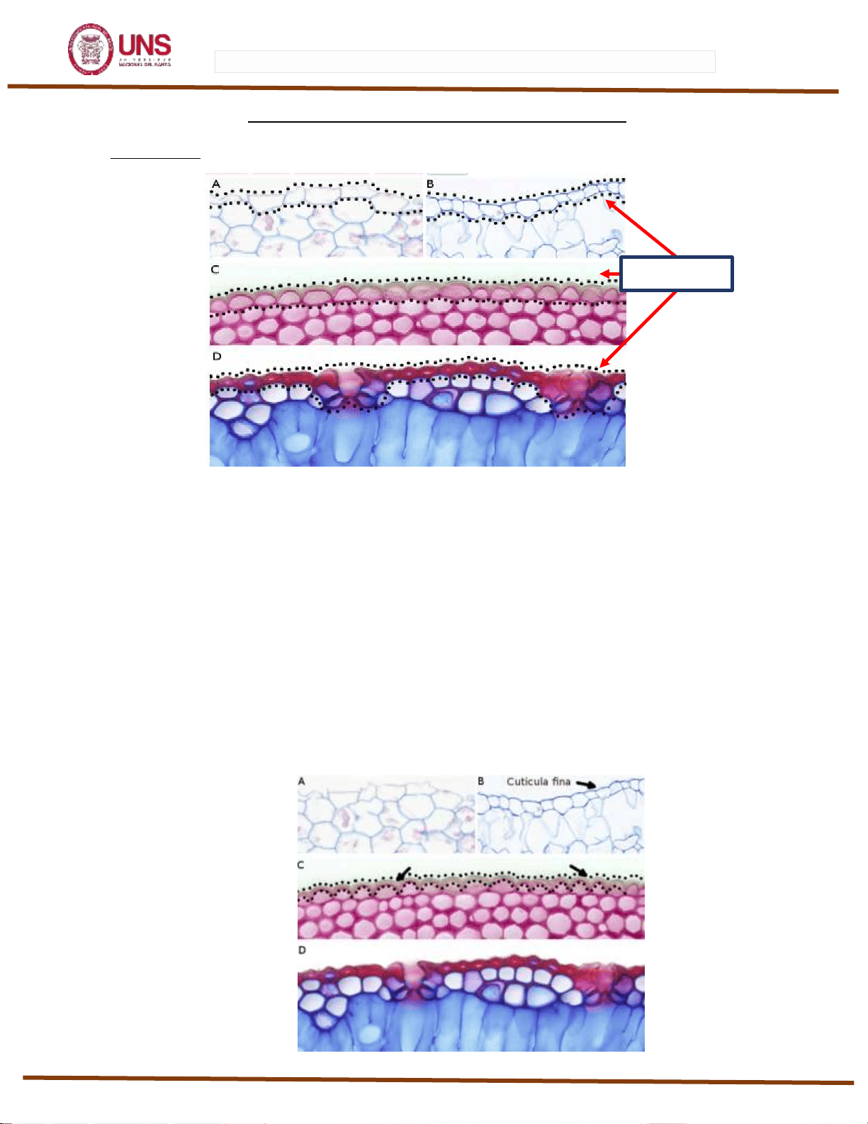 bg1