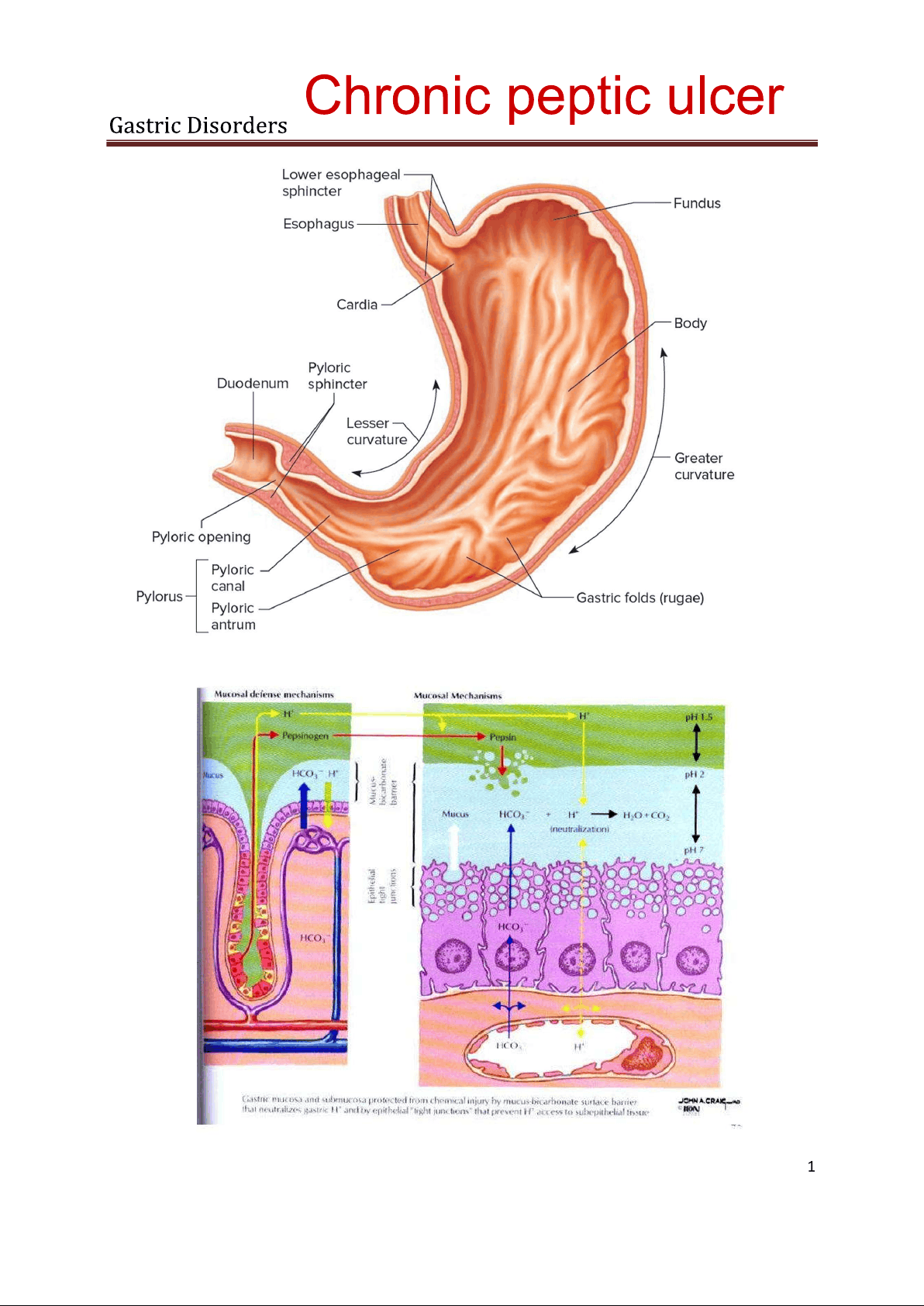 bg1