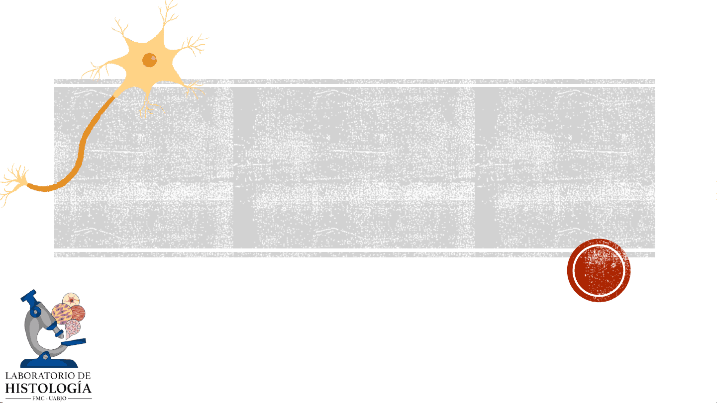 bg1