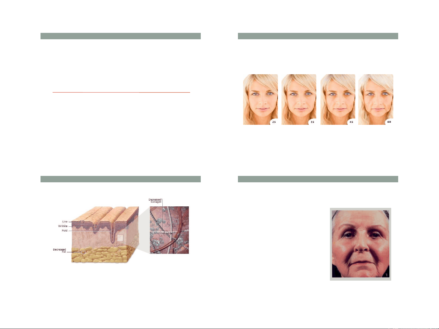 bg1