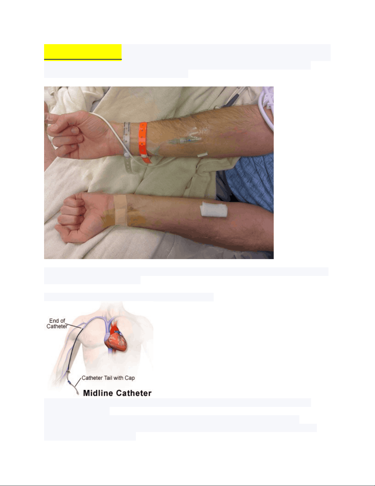 bg1