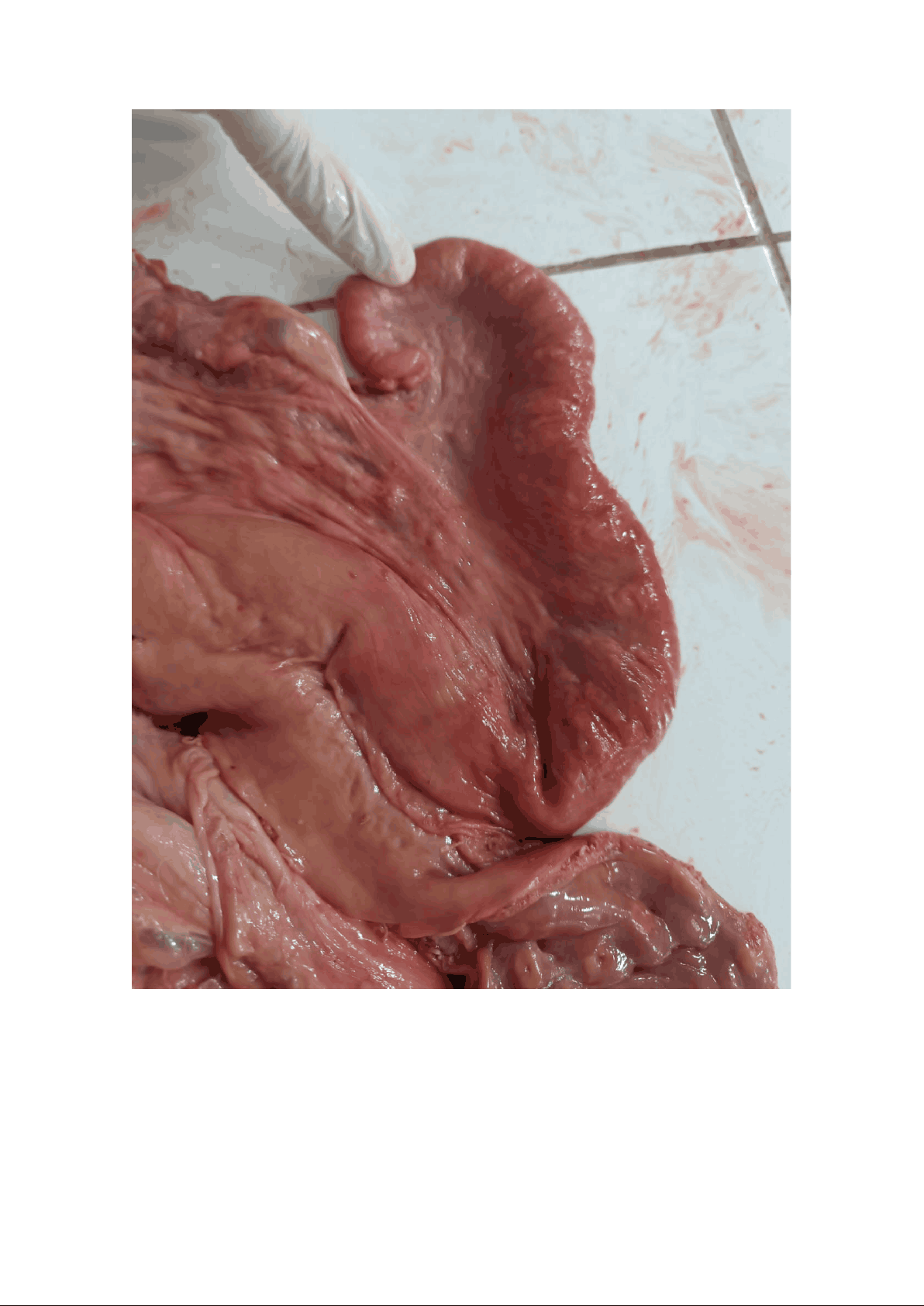 bg1
