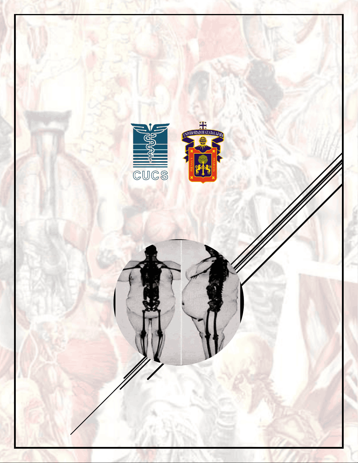 bg1