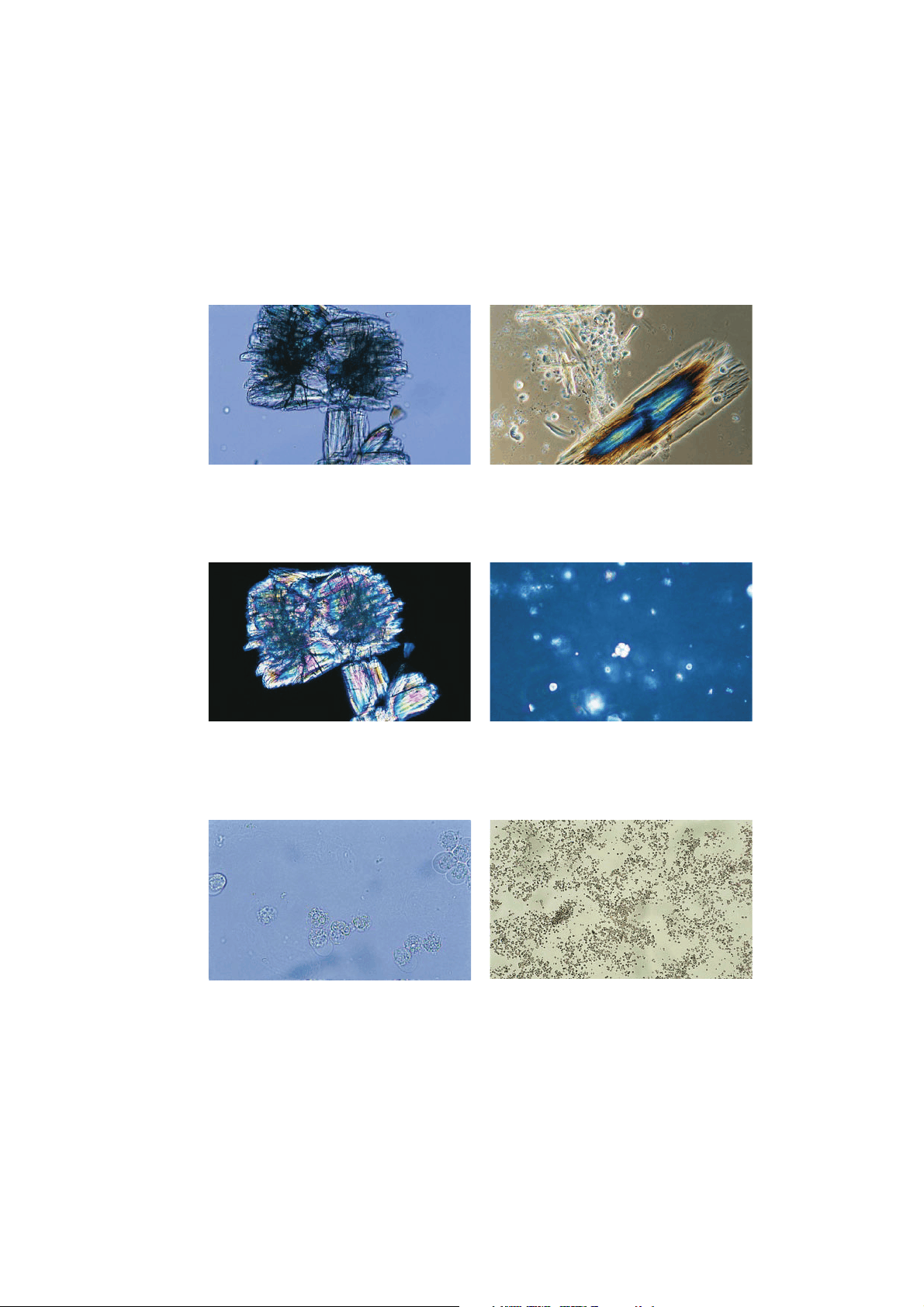 bg1