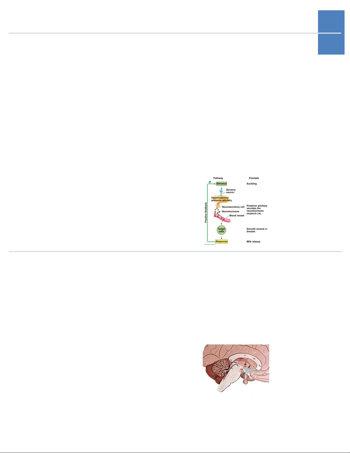 bg1