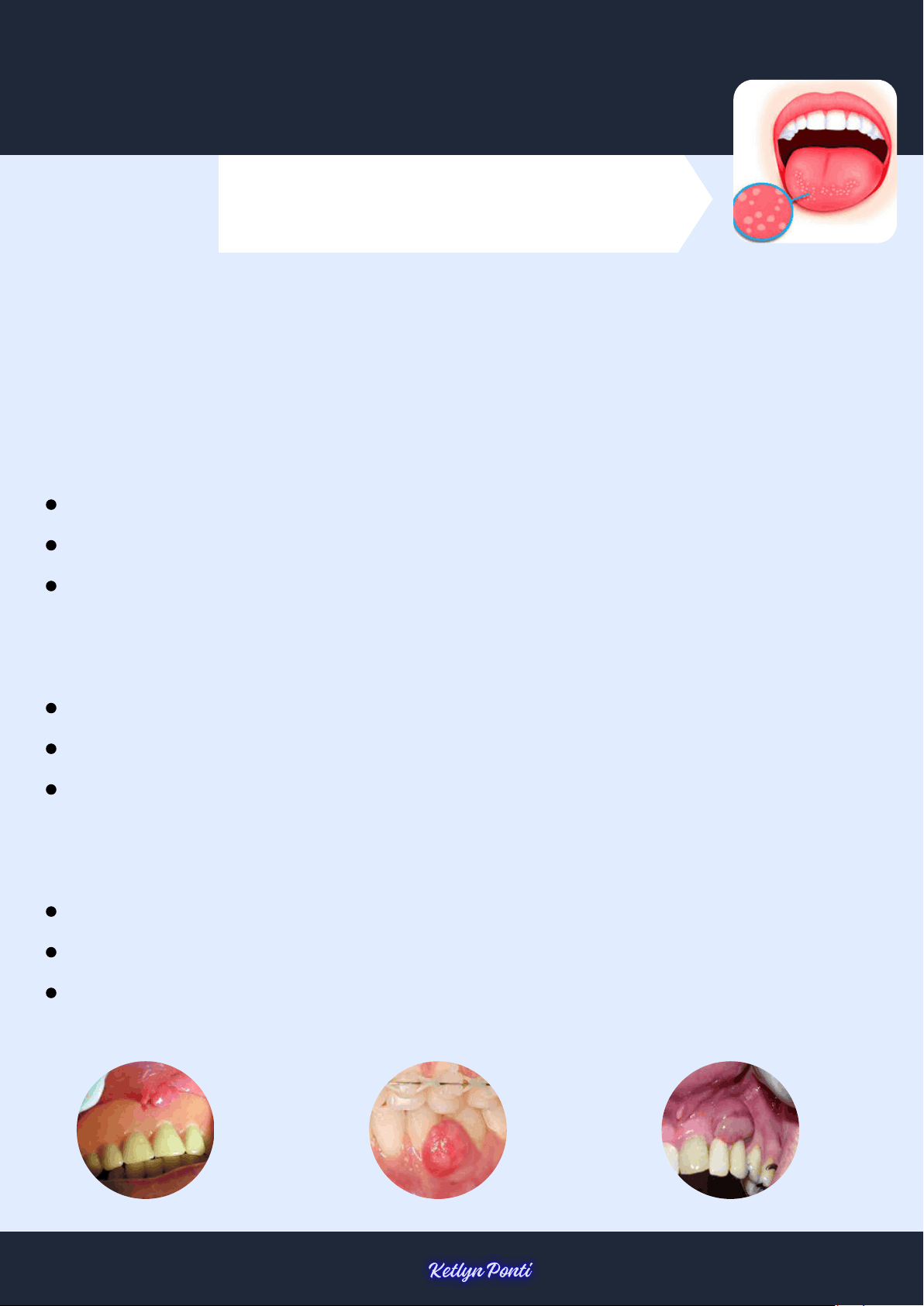bg1