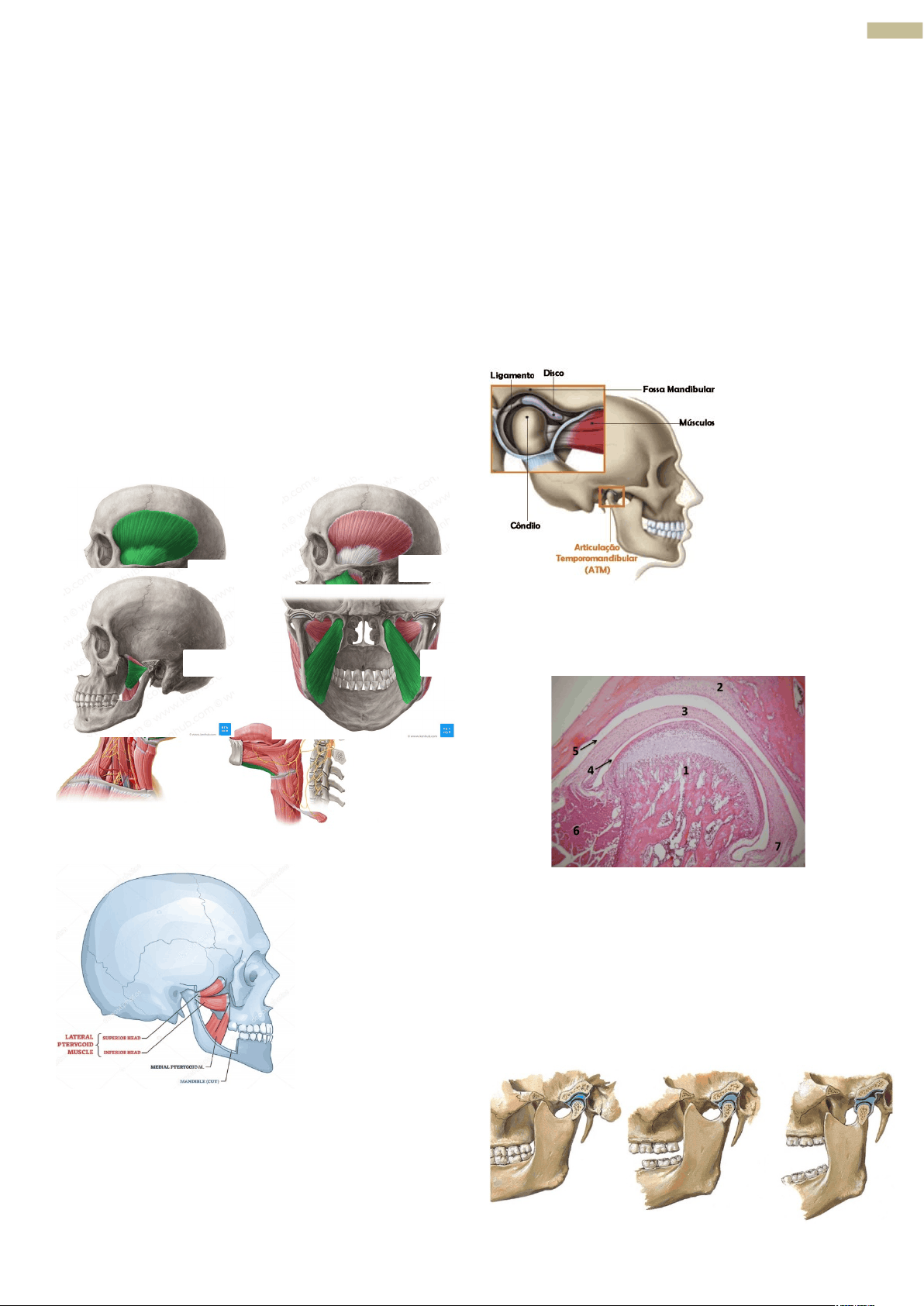 bg1