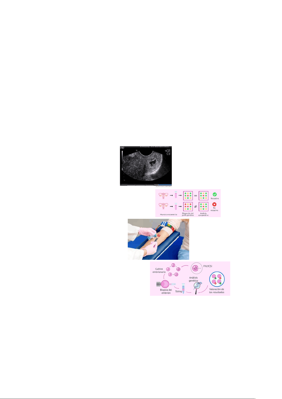 bg1