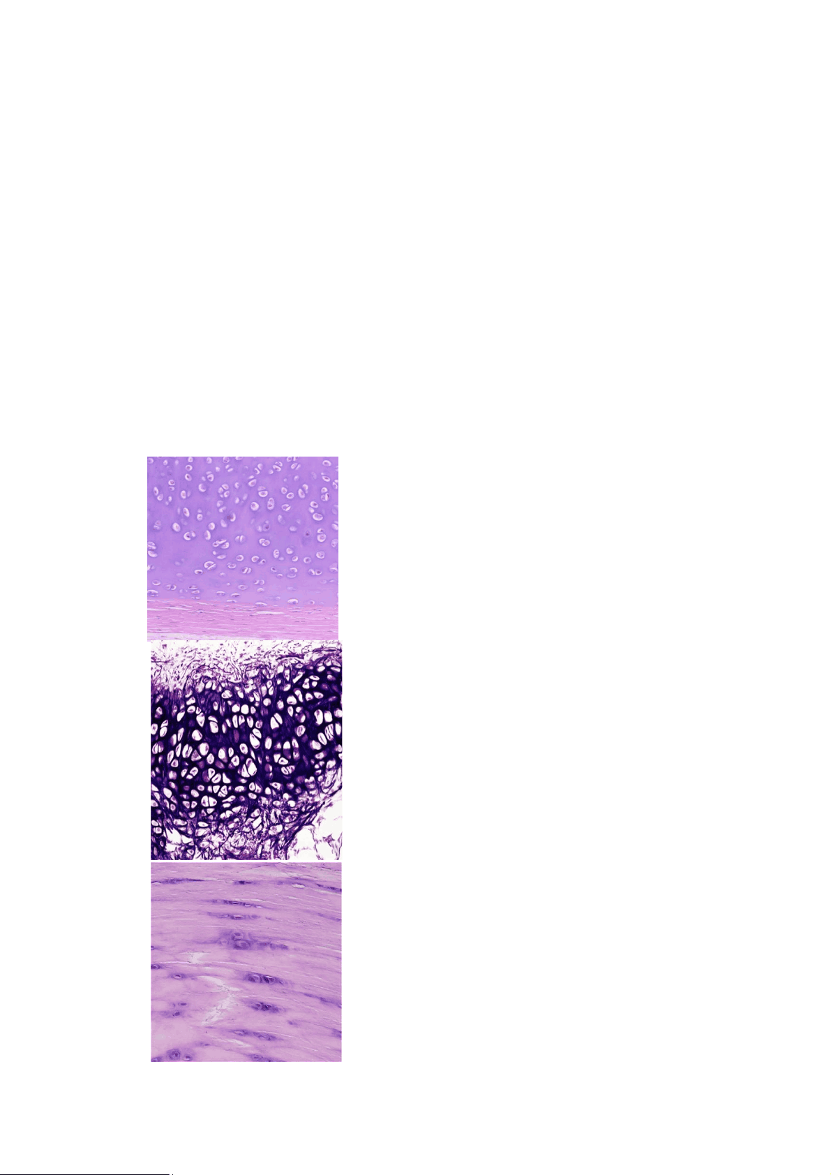 bg1