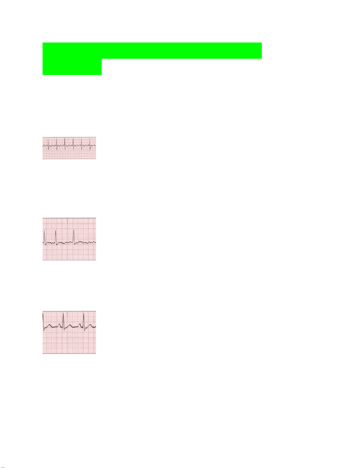 bg1