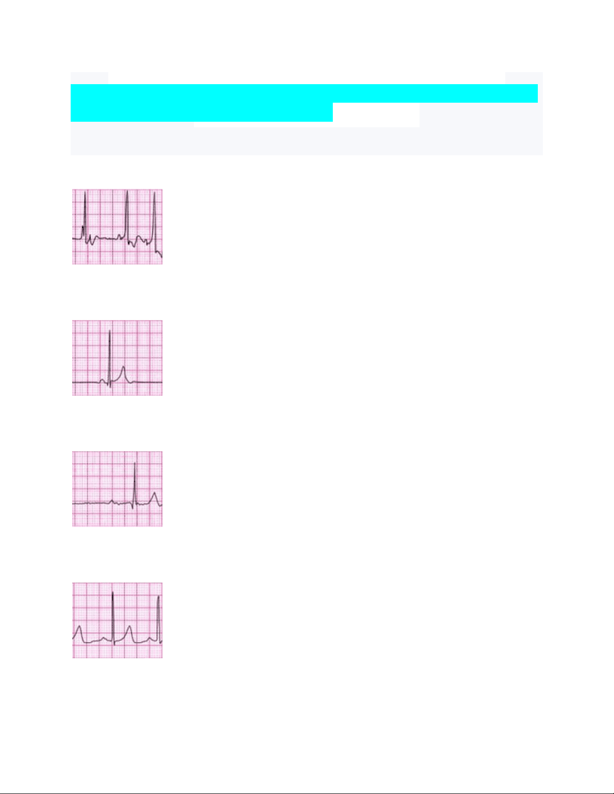 bg1