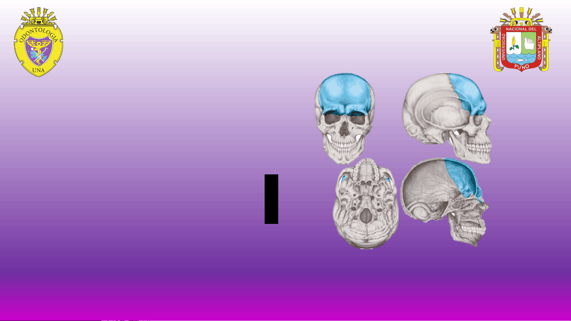 bg1