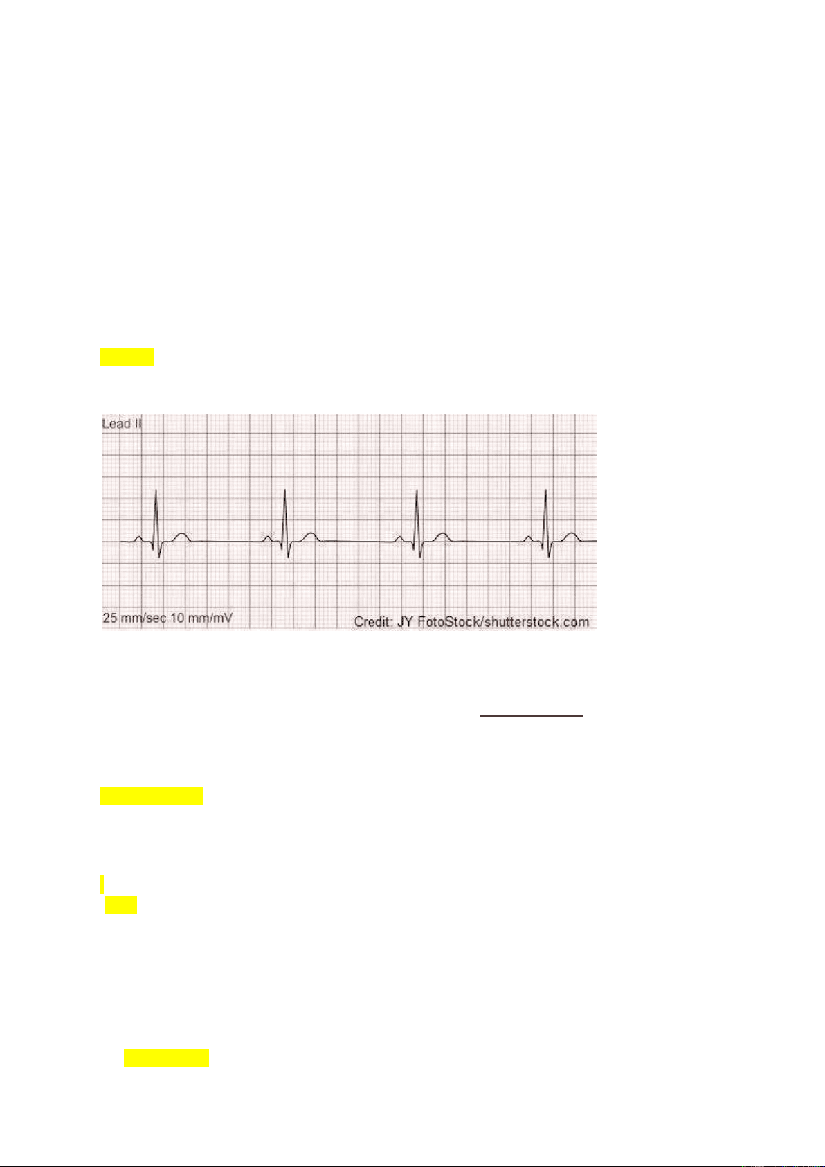 bg1