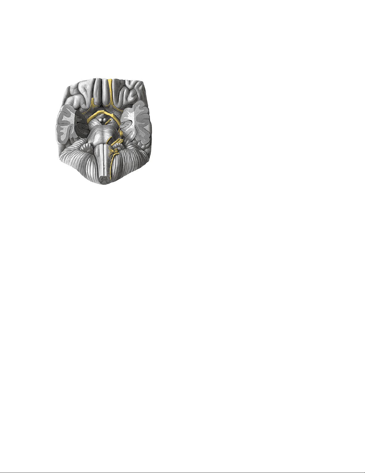 bg1
