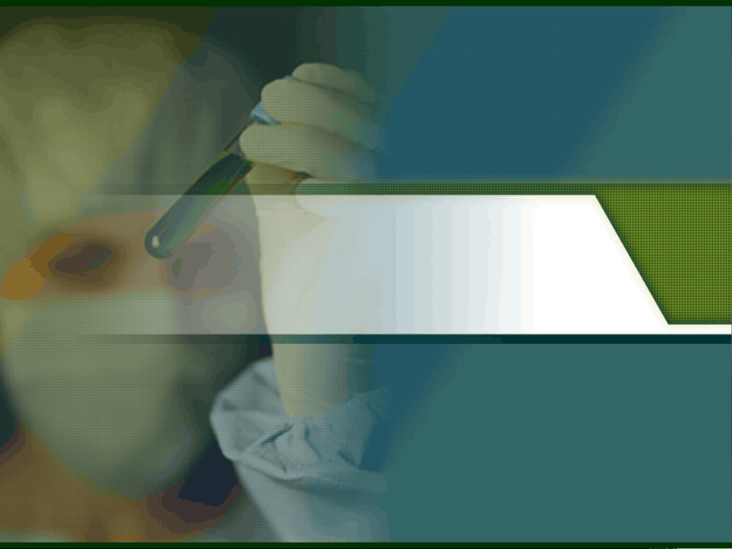 bg1