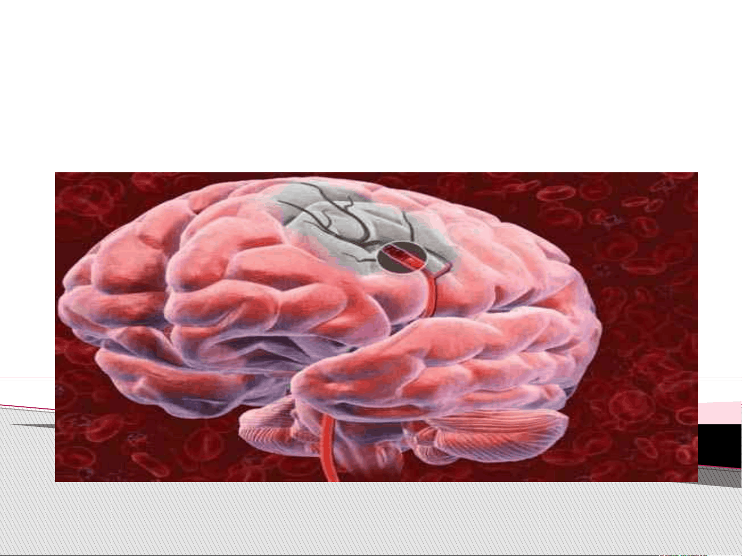 bg1