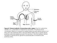 Methods for Measuring Cardiac Output: Fick, Dye-Dilution, and Thermodilution