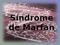 Síndrome de Marfan