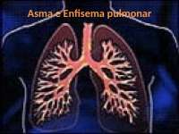 Doença Pulmonar Obstrutiva Crônica (DPOC)