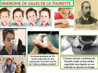 Síndrome de Gilles de La Tourret