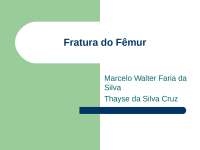 Fratura do fêmur: conceito e causas